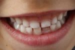 cómo enseñar a los niños a lavarse los dientes